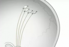 Neuralink AI腦芯片可以在人類身上進(jìn)行測試