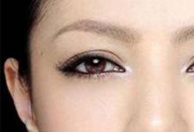 日常生活:眉毛里有痣代表什么