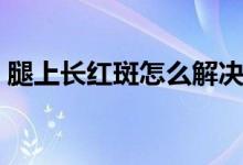 腿上長(zhǎng)紅斑怎么解決（腿上長(zhǎng)紅斑怎么回事）