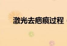 激光去疤痕過(guò)程（激光去疤痕多少錢(qián)）