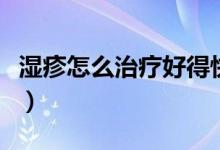濕疹怎么治療好得快?。裾钤趺粗委熀玫每欤?class=