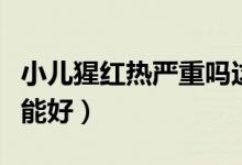 小兒猩紅熱嚴(yán)重嗎這種?。ㄐ盒杉t熱多少天能好）