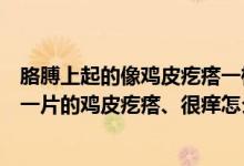胳膊上起的像雞皮疙瘩一樣還癢怎么回事（胳膊上起了一片一片的雞皮疙瘩、很癢怎么回事）