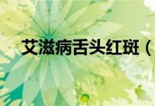 艾滋病舌頭紅斑（艾滋病舌頭紅點(diǎn)特點(diǎn)）