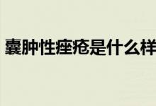 囊腫性痤瘡是什么樣（囊腫性痤瘡是什么?。?class=