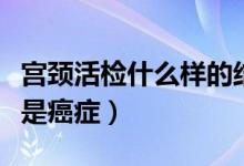 宮頸活檢什么樣的結(jié)果是癌癥（宮頸活檢幾點是癌癥）
