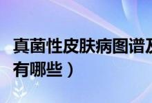 真菌性皮膚病圖譜及診療建議（真菌性皮膚病有哪些）