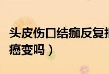 頭皮傷口結(jié)痂反復(fù)摳的后果（頭皮反復(fù)摳痂會(huì)癌變嗎）