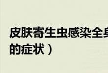 皮膚寄生蟲(chóng)感染全身性瘙癢（皮膚寄生蟲(chóng)感染的癥狀）
