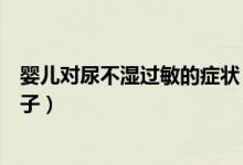 嬰兒對(duì)尿不濕過(guò)敏的癥狀（寶寶帶尿不濕過(guò)敏癥狀是什么樣子）