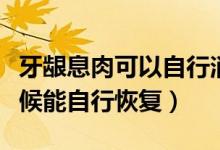 牙齦息肉可以自行消退嗎（牙齦有息肉什么時(shí)候能自行恢復(fù)）