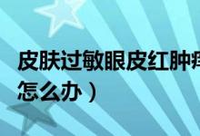 皮膚過(guò)敏眼皮紅腫癢怎么辦（眼皮過(guò)敏紅腫癢怎么辦）