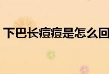 下巴長(zhǎng)痘痘是怎么回事（下巴長(zhǎng)痘痘的原因）
