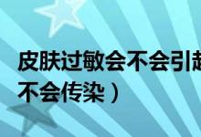 皮膚過敏會不會引起白細(xì)胞升高（皮膚過敏會不會傳染）
