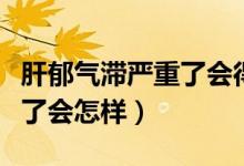 肝郁氣滯嚴(yán)重了會(huì)得抑郁癥嗎（肝郁氣滯嚴(yán)重了會(huì)怎樣）