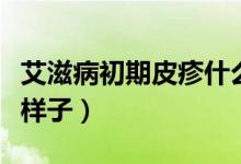 艾滋病初期皮疹什么樣（艾滋病初期皮疹什么樣子）