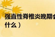 強直性脊椎炎晚期會癱瘓嗎（強直性脊椎炎是什么）