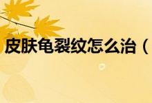 皮膚龜裂紋怎么治（皮膚龜裂應(yīng)該怎樣護(hù)理）