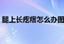 腿上長疙瘩怎么辦圖片（腿上長疙瘩怎么辦）