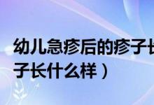 幼兒急疹后的疹子長什么樣（幼兒急疹出的疹子長什么樣）