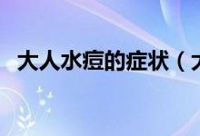 大人水痘的癥狀（大人水痘的癥狀和治療）