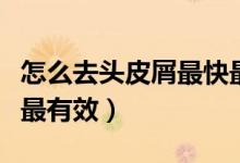 怎么去頭皮屑最快最有效(怎么去頭皮屑最快最有效)