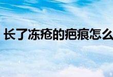 長了凍瘡的疤痕怎么去除（凍瘡很癢怎么辦）