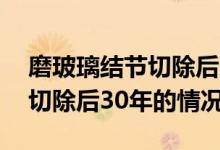 磨玻璃結節(jié)切除后30年存活率（磨玻璃結節(jié)切除后30年的情況）